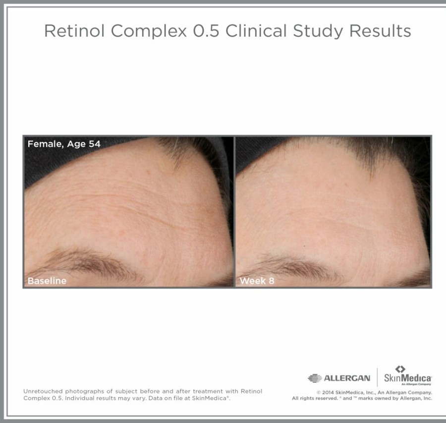 Serums And Treatments * | Special Skinmedica Retinol Complex 0.5